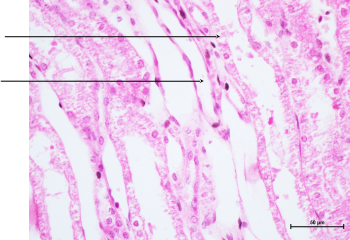 Collecting Tubules 1